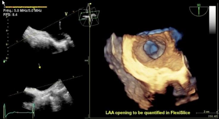 GE Healthcare Enhances Workflow With 4-D TEE Transducer | Imaging